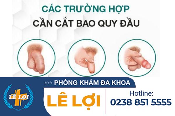 Cac-truong-hop-can-cat-bao-quy-dau